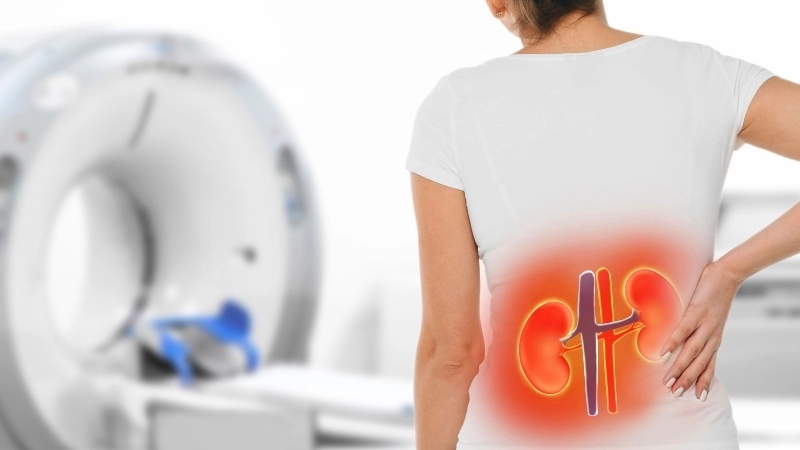  Bác sĩ kiểm tra vùng lưng để chẩn đoán phân biệt giữa đau thận và đau cơ