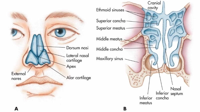 Cấu trúc bên trong mũi cho thấy niêm mạc bị sưng khi viêm