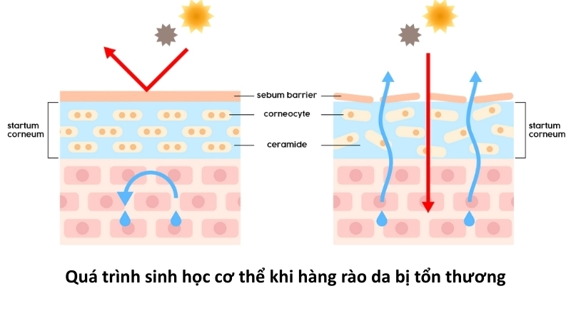  Minh hoạ quá trình sinh học cơ thể khi hàng rào da bị tổn thương