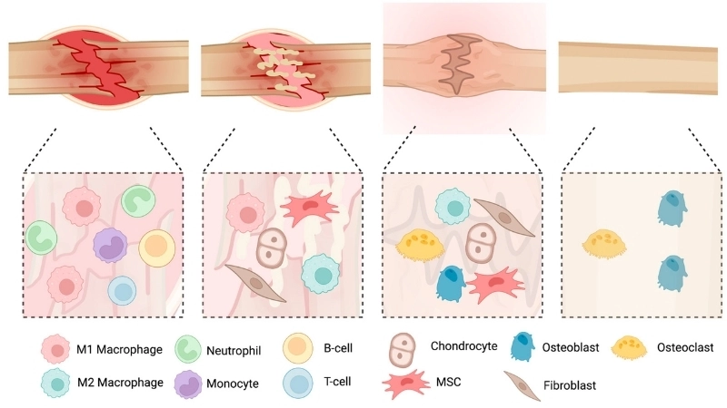  Quá trình sinh học cơ thể giúp xương tự tái tạo sau chấn thương