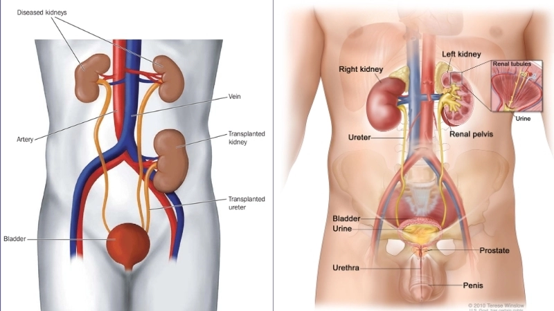 Vì sao chúng ta có thể bị đau thận âm ỉ hoặc dữ dội?