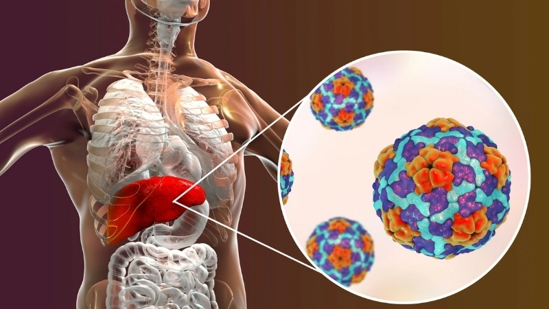  Viêm gan là một trong những nguyên nhân chính gây tổn thương gan