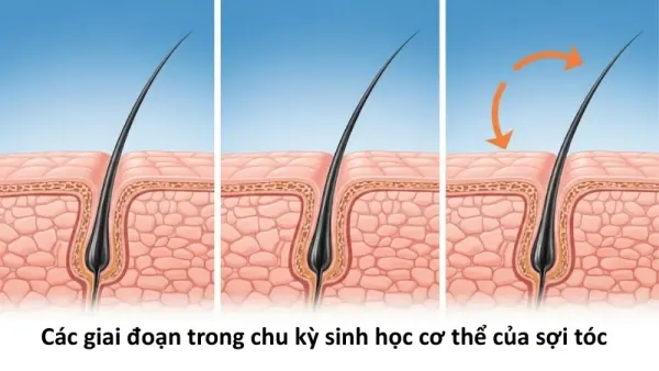 Vì sao chúng ta có thể bị rụng tóc? Cơ chế rụng tóc