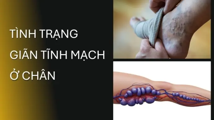 Vì sao chúng ta có thể bị đau chân bất chợt?