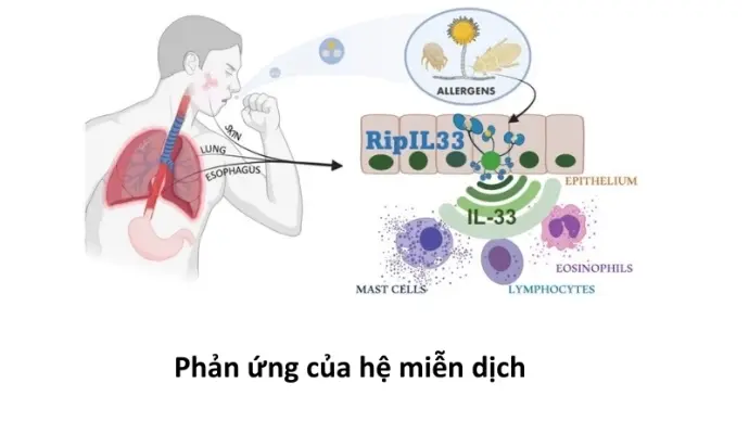 Vì sao chúng ta có thể bị viêm da? Hệ vi sinh vật trên da