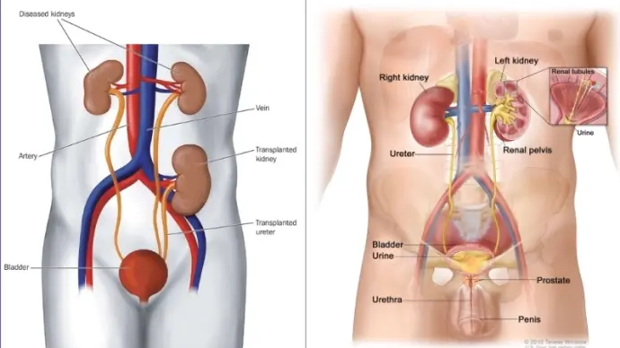 Vì sao chúng ta có thể bị đau thận âm ỉ hoặc dữ dội?