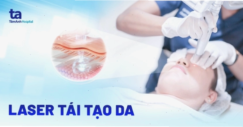 Công nghệ laser trong thẩm mỹ làm đẹp