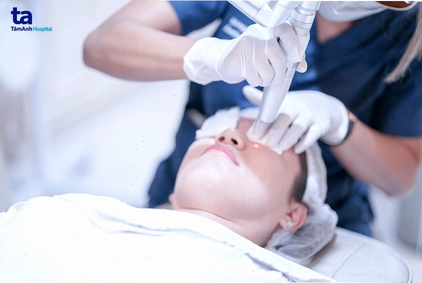 Hướng dẫn chăm sóc da sau khi sử dụng laser