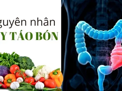 Vì sao chúng ta bị táo bón? Phòng ngừa chứng táo bón