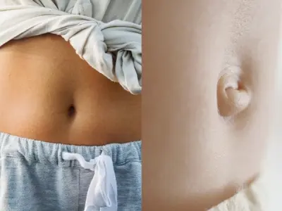 Vì sao chúng ta có rốn? Dấu vết kết nối sự sống đầu đời