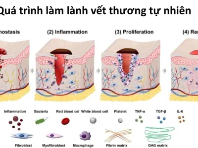 Vì sao chúng ta có thể bị bỏng? Phản ứng của cơ thể