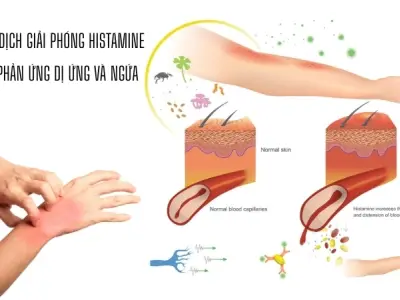Vì sao chúng ta bị ngứa? Tín hiệu từ thần kinh