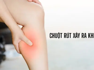 Vì sao chúng ta bị chuột rút? Giải mã cơn co cơ bất ngờ